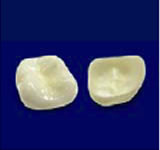 ジルコニアセラミックポーセレン築盛臼歯部