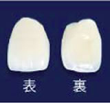 オールセラミック(e.max)前歯部