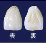 ジルコニアセラミックポーセレン築盛前歯部