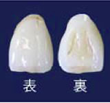 ジルコニアセラミックプレミアム前歯部