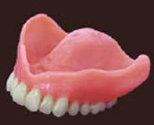 ノンクラスプ義歯 総入れ歯